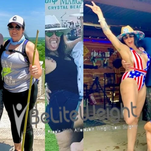 Donna M - 2 Year Update*